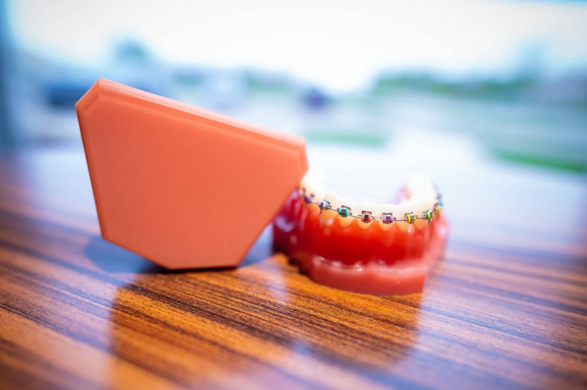 Typodont with metal braces - Align Orthodontics