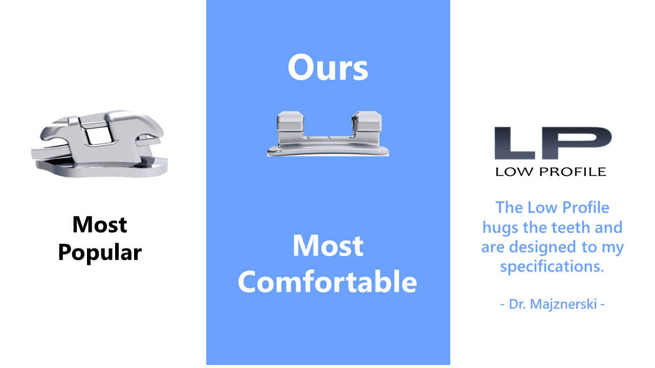 Low profile brackets for braces - Align Orthodontics