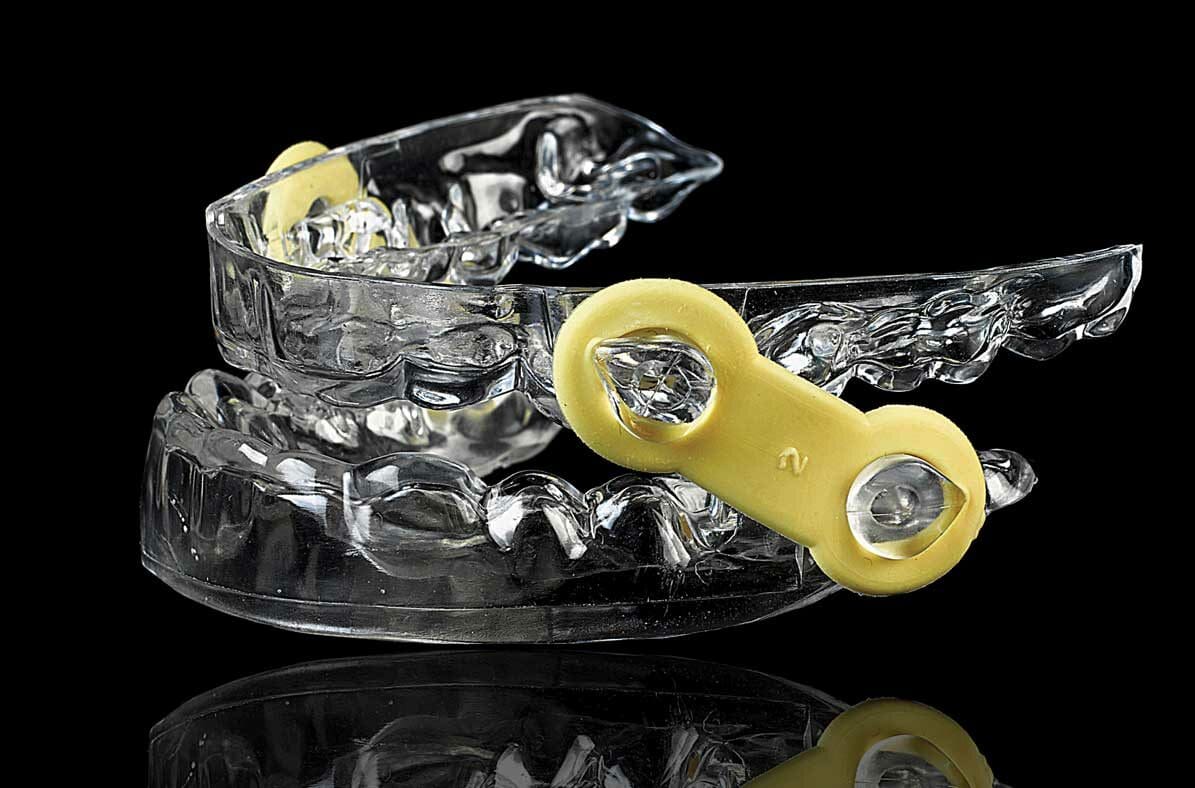A photo of a simple oral device that eliminates snoring and the need for a CPAP.